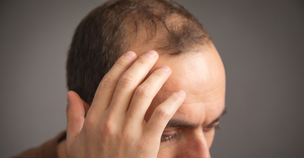 Tratamento para Alopecia com Dra. Karen Lima Tricologista