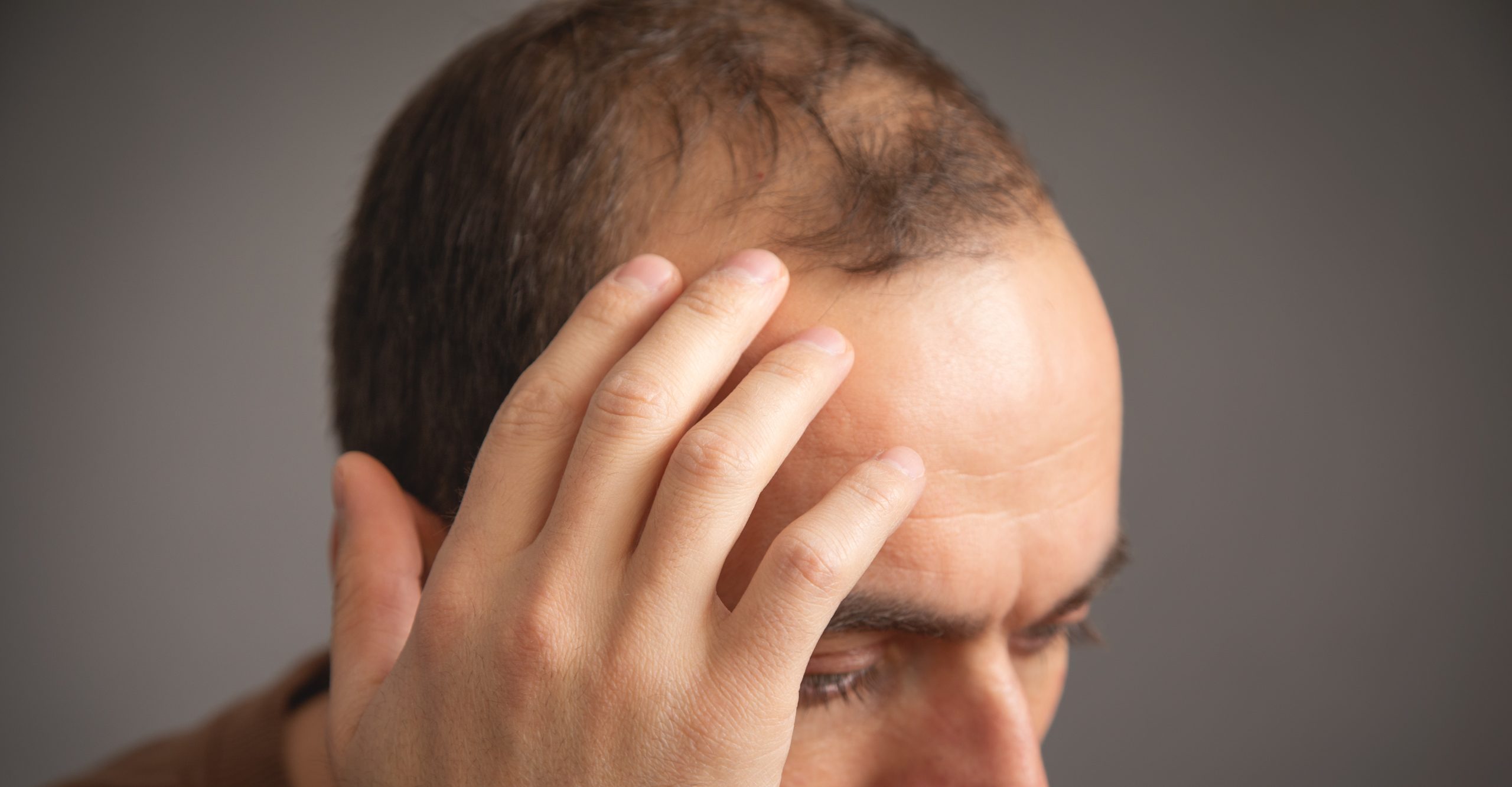 Tratamento para Alopecia com Dra. Karen Lima Tricologista