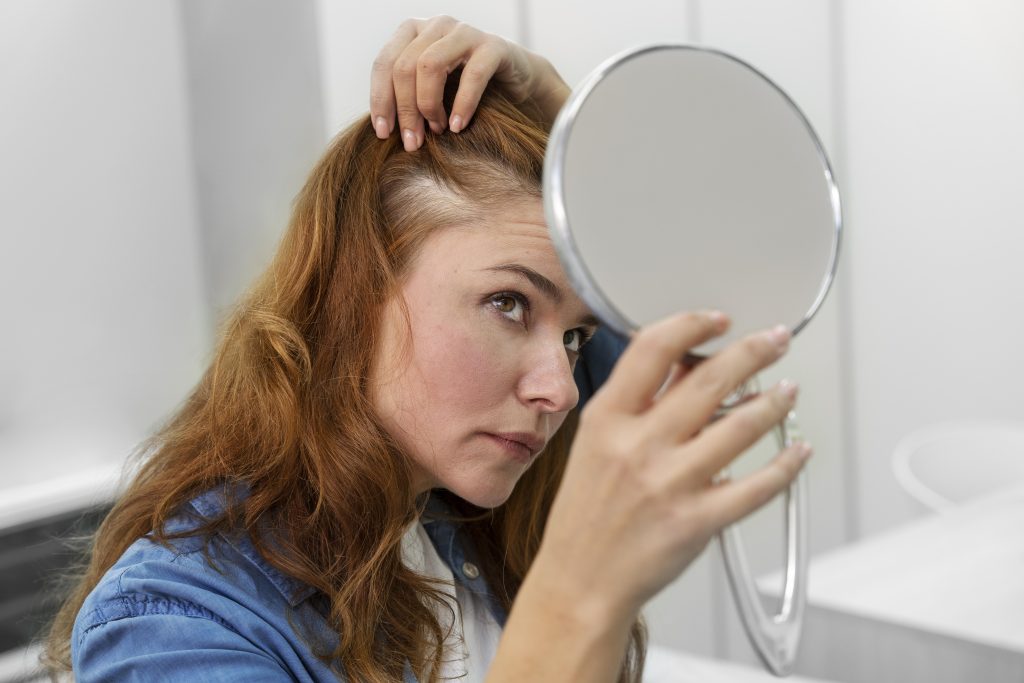 Soluções Personalizadas para Alopecia