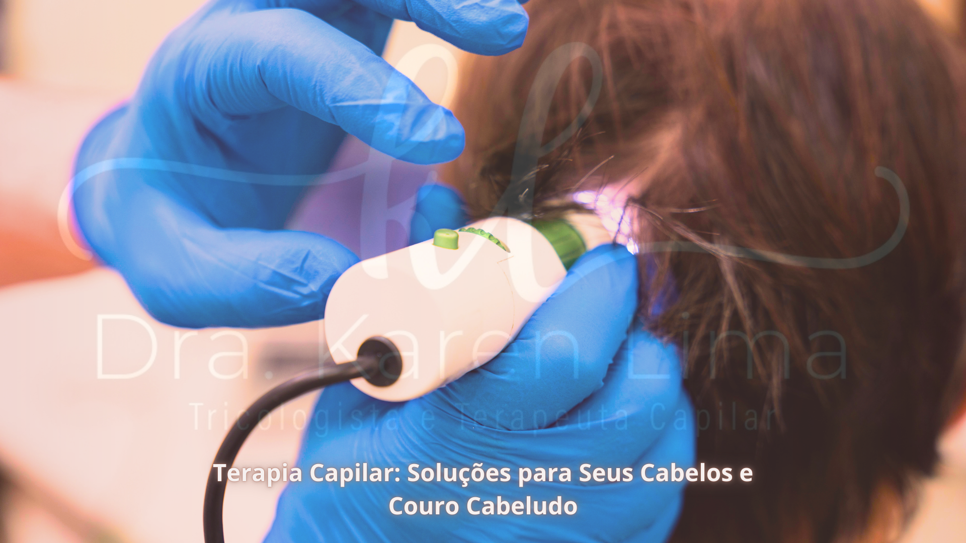 Terapia Capilar