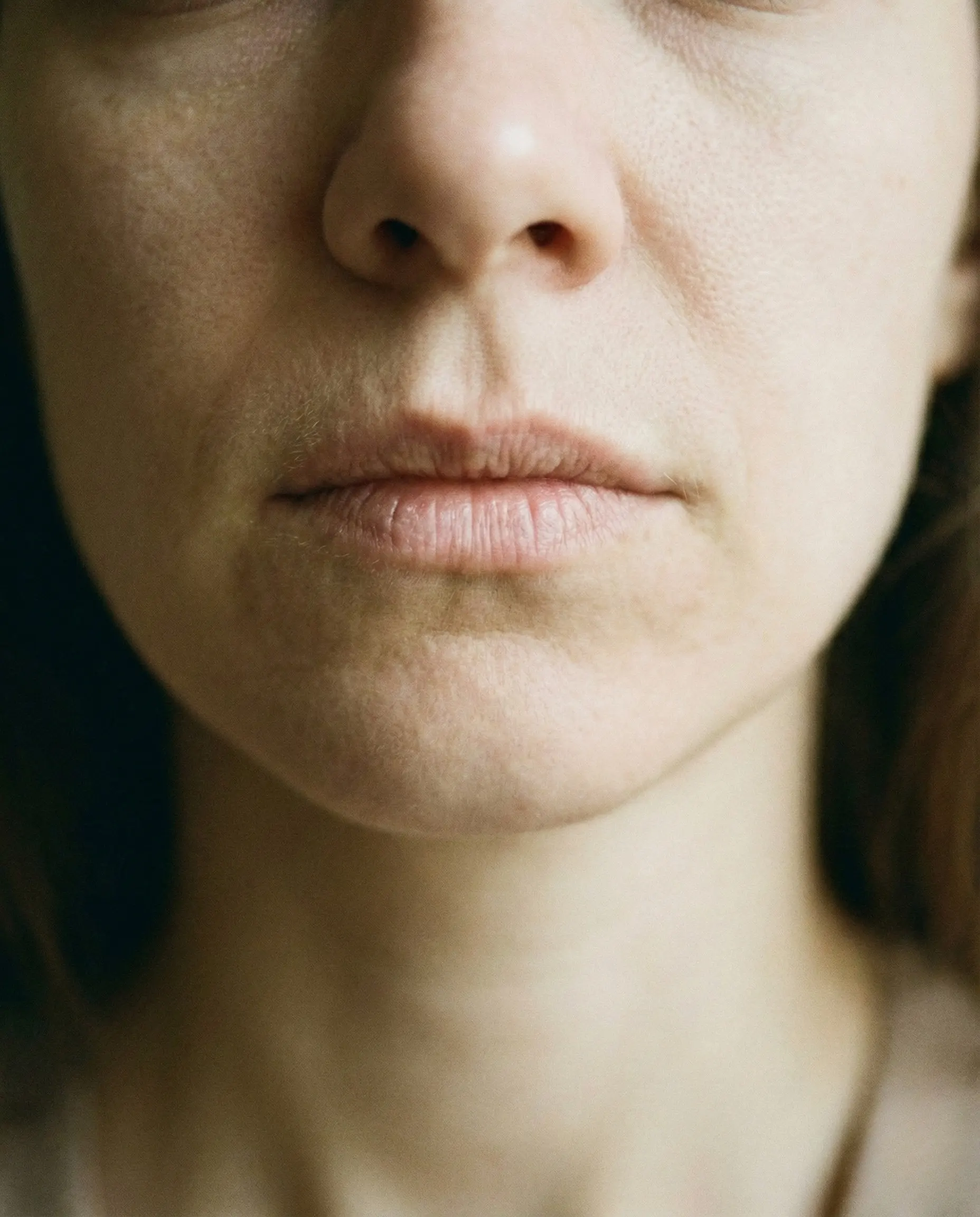 Close-up de lábios finos, pálidos e sem volume definido de uma paciente, representando a queixa principal de envelhecimento labial antes do tratamento.